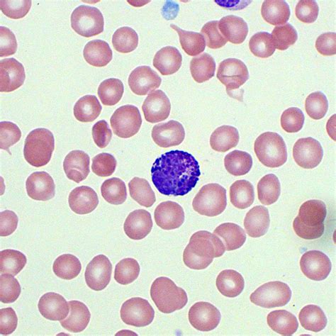 Basophils | Blood Film - MedSchool