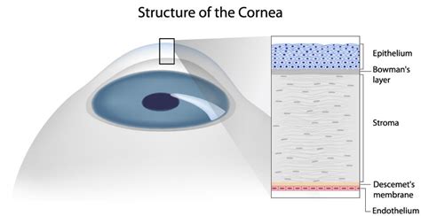 Cornea Las Vegas | Corneal Disease Las Vegas | Shepherd Eye