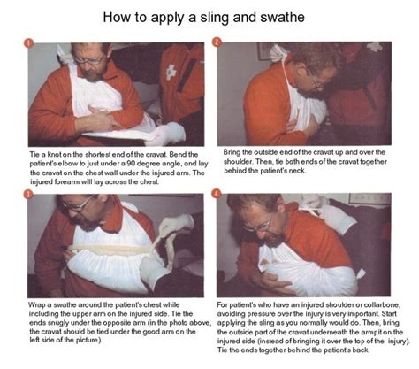 Splinting Fractures & Joints - Basic Wilderness First Aid