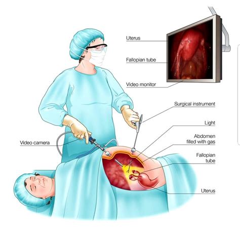 Endometriosis : Endometriosis: Symptoms, diagnosis, and treatment ...