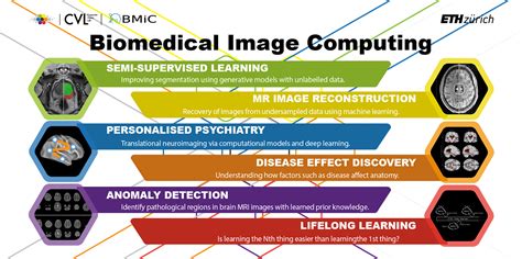 Research – Biomedical Image Computing | ETH Zurich