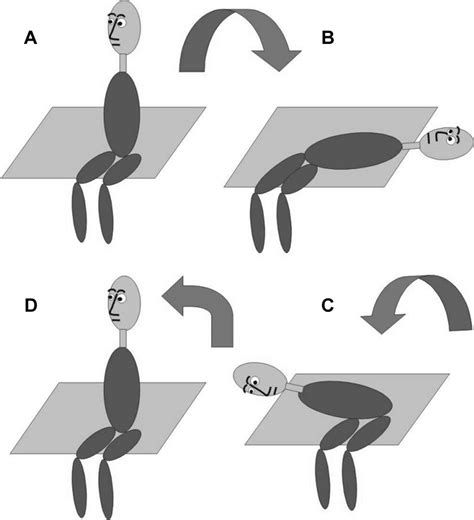 The Semont maneuver when the posterior semicircular canal of the left ...