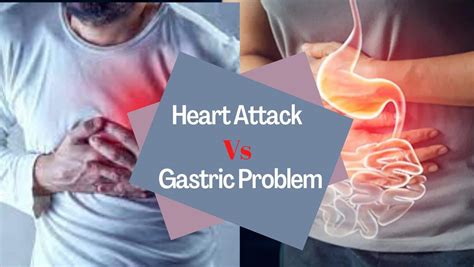 Gastric Problem Symptoms