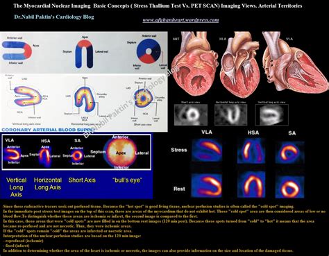 Dr.Nabil Paktin's Cardiology Blog مجله کاردیولوژی دکتور نبــیل پاکطـین ...