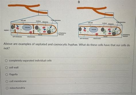 Solved Above are examples of septated and coenocytic hyphae. | Chegg.com