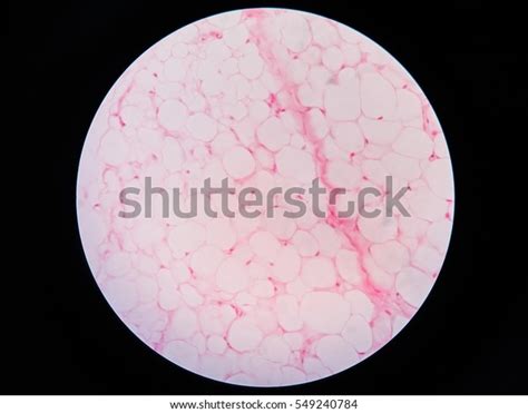 Human Fat Body Tissue Under Microscope Stock Photo (Edit Now) 549240784