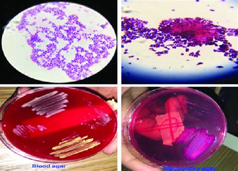 Growth type of bacteria. | Download Scientific Diagram