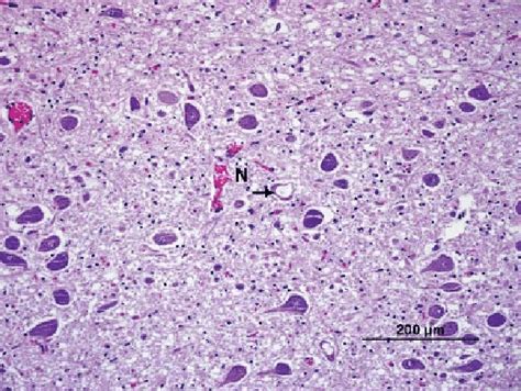 Photomicrograph of the dorsal motor nucleus of the vagus nerve of the... | Download Scientific ...