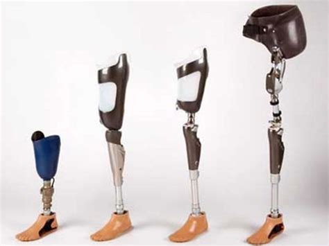 Everything You Need To Know About Using Limb Prosthetic Devices - Boldsky.com