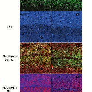 Neprilysin activities, A β levels and APP metabolism in... | Download Scientific Diagram