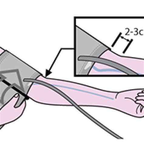 How to Position the Blood Pressure Monitor Cuff?