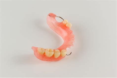 Acrylic vs Metal Partial Dentures: Pros and Cons