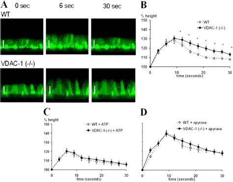 Hypotonicity-induced swelling and RVD of WT and VDAC-1 (−/−) mouse... | Download Scientific Diagram