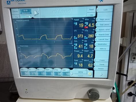 How to use ventilator with Type of modes Modes and use- Surgicaltechie.com