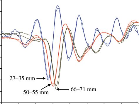 Auditory evoked potentials from the 27-35·mm, the 50-55·mm and 66-71·mm... | Download Scientific ...