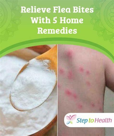 Relieve Flea Bites With 5 Home Remedies Beyond relieving the itching ...