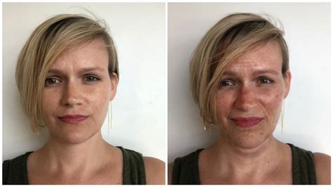 This Terrifying App Shows You What Not Using Sunscreen Will Do to Your ...