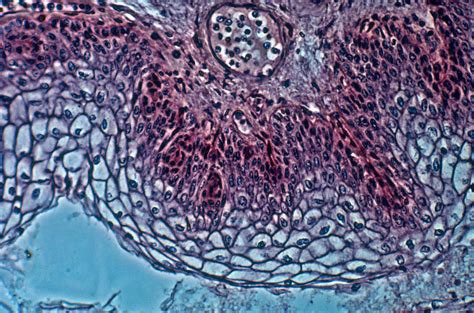 Stratified Squamous Epithelium Location