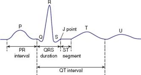 The Normal Electrocardiogram | Thoracic Key