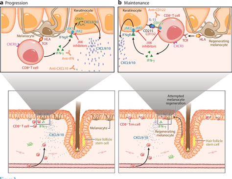 Figure 2 from Vitiligo: Mechanisms of Pathogenesis and Treatment ...