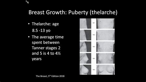 Endocrinology of the Breast - YouTube