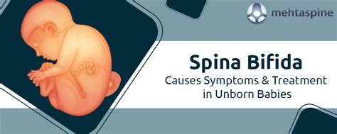 Spina Bifida Causes Symptoms & Treatment in Unborn Babies