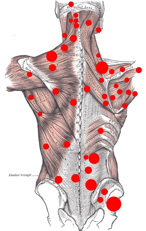 Dr. Rubanenko Chiropractor Sorrento Valley, San Diego, CA :: Trigger Point Release Therapy