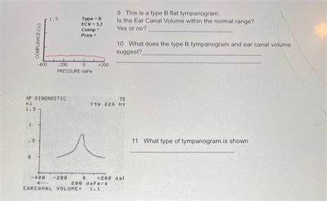 Solved 9 This is a type B flat tympanogram. Is the Ear Canal | Chegg.com