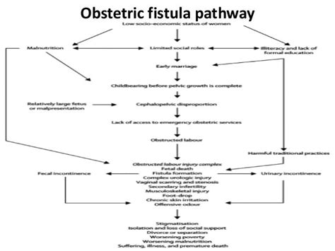 Obstetric fistula