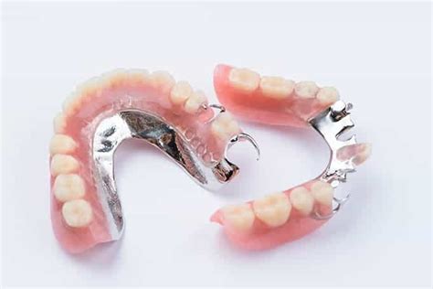 Types and Cost of Partial Dentures | District Dentistry Charlotte