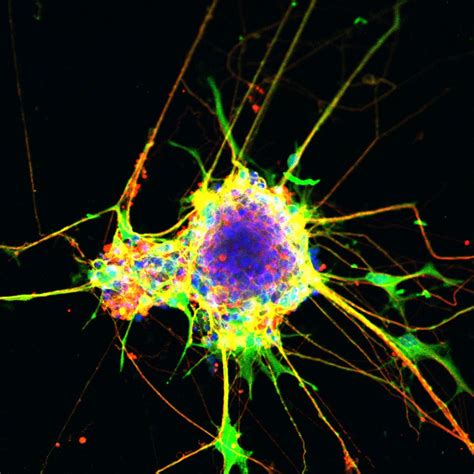 Finding a cause of neurodevelopmental disorders - Salk Institute for Biological Studies