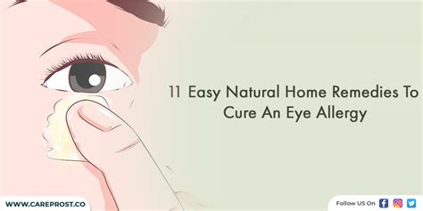 11 Easy Natural Home Remedies To Cure An Eye Allergy