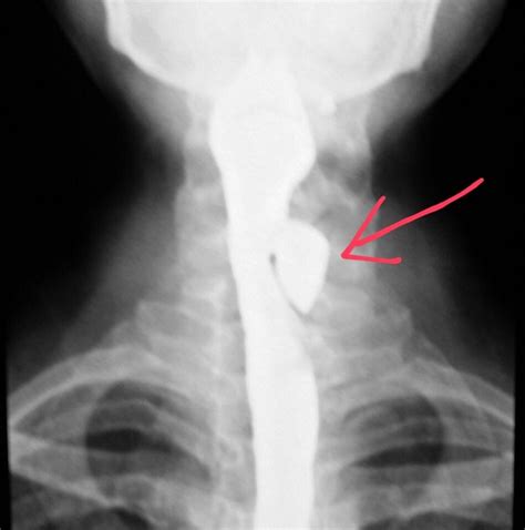 Pin on X-rays