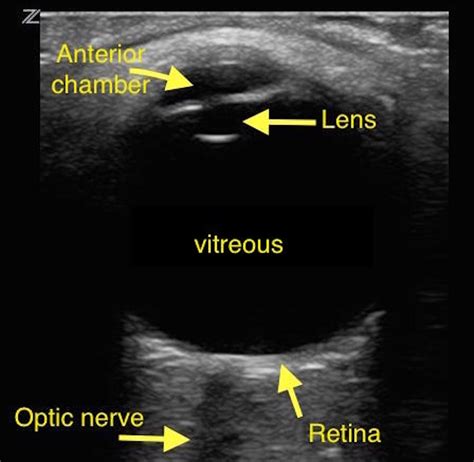 Anatomy Ultrasound