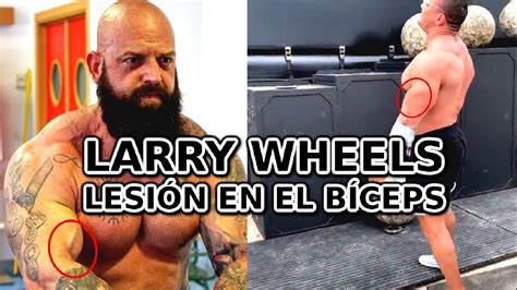 LARRY WHEELS - LESIÓN EN EL BÍCEPS - YouTube