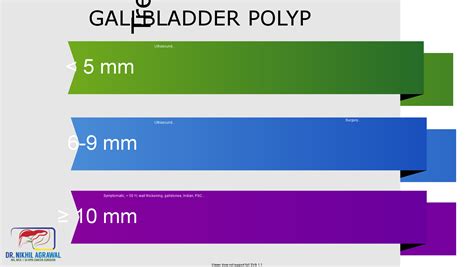 Treatment of gallbladder polyp