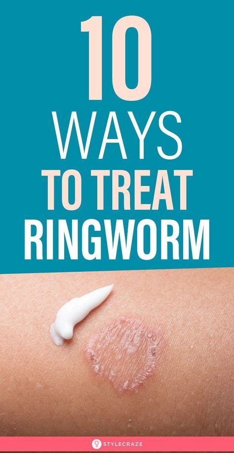 Home Remedies For Ringworms – 10 Ways To Treat The Symptoms | Organic ...