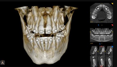 Carestream Dental EMR Software | Latest Reviews, Pricing & Demo | EMRSystems