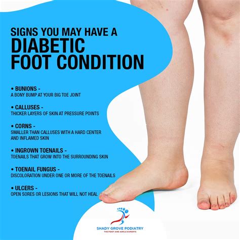 Signs You May Have A Diabetic Foot Condition [Infographic]