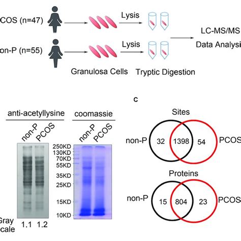 | Lysine acetylation of proteins regulates metabolic pathways in PCOS... | Download Scientific ...