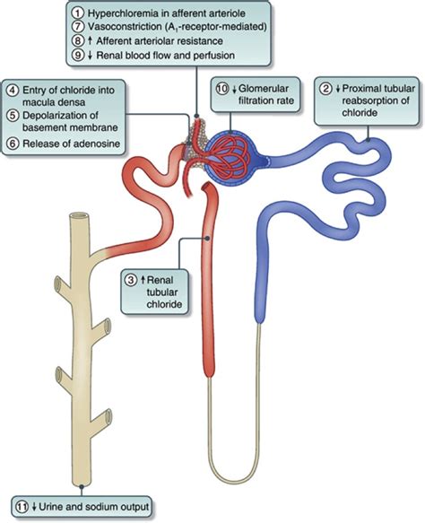 hyperchloremia - County EM