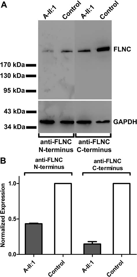 FLNC Gene Splice Mutations Cause Dilated Cardiomyopathy | JACC: Basic ...