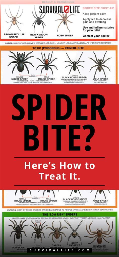 Lou McLeod: Spider Bite? Here’s How to Treat It