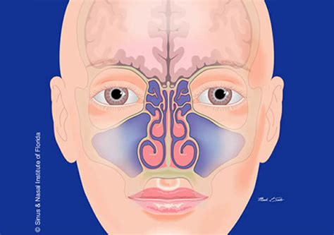 Sinus & Nasal Institute of Florida