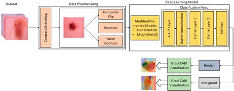 Sensors | Free Full-Text | Classification of Skin Cancer Lesions Using ...