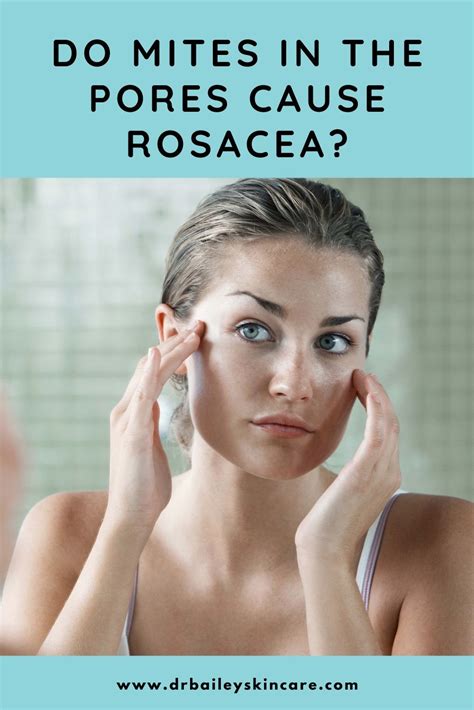 Do Mites in the Pores Cause Rosacea? in 2021 | Rosacea, Antioxidants skin, Skin cleansing brush