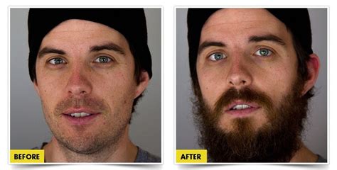 Top 7 Beard Growth Products: Insider's Review & Buying Guide