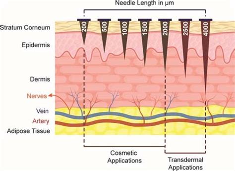 Variations of the needle length in derma rollers and their application | Download Scientific Diagram