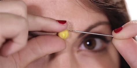 How To Pop A Spot Properly: A Step-By-Step Guide For Tackling Zits ...