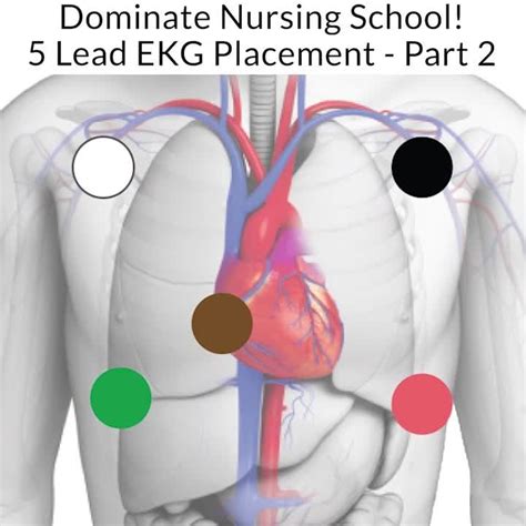 Pin by Nursing on Nursing School | Ekg placement, Nursing school problems, Nursing books